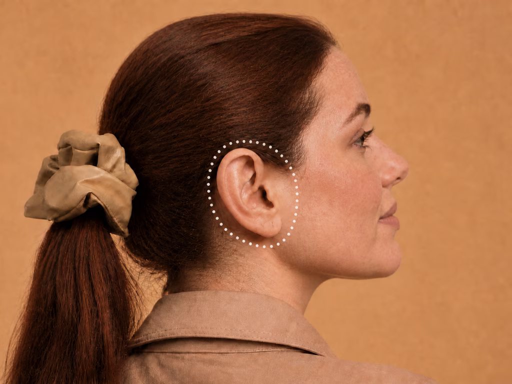 Perfil feminino com orelha proeminente (orelha de abano) e marcação pontilhada ao redor — otoplastia
